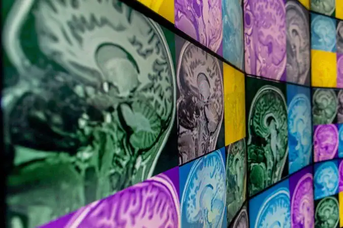 Imagens dos cérebros de 79 idosos: cientistas mensuraram a concentração de três neuroquímicos em áreas-chave do órgão - (crédito: University of the Sunshine Coast/Divulgação)