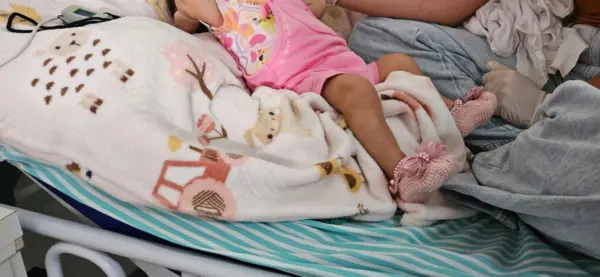Acre em estado de emergência: Sazonalidade do vírus sincicial respiratório somada à seca extrema e ao calor ameaça saúde de crianças de até 6 anos