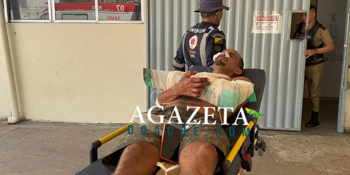 Homem sofre tentativa de homicídio a golpes de terçado em Rio Branco e fica com fratura exposta