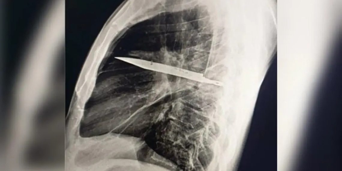 Journal of Surgical Case Reports