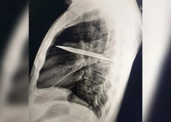 Journal of Surgical Case Reports
