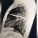 Journal of Surgical Case Reports