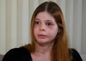 "Durante as agressões, o Pedro quebrou todas as estruturas que seguram o meu globo ocular, além de vários ossos da minha face, principalmente do lado esquerdo", revelou a médica em entrevista ao Fantástico - (crédito: Reprodução/TV Globo)