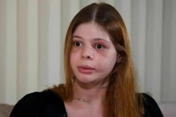 Médica agredida por fisiculturista no dia do aniversário não pode mais sorrir
