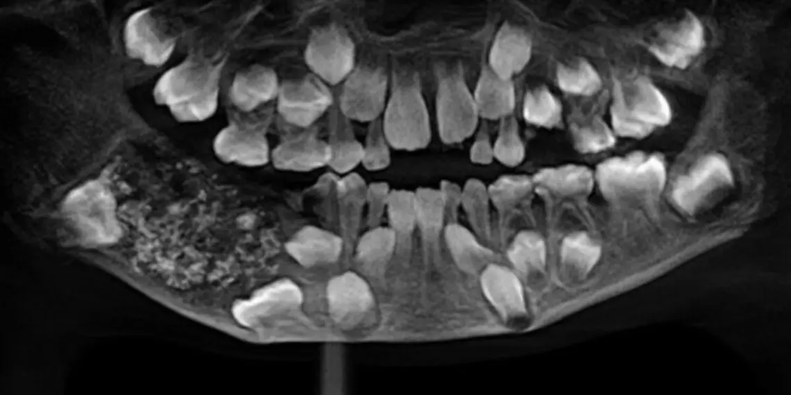 Foto: Saveetha Dental College and Hospitals/Divulgação