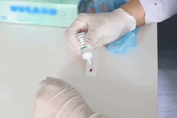 Homem de SP fica 17 meses curado do HIV com tratamento experimental