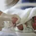 Brasil sanciona lei para reduzir mortalidade de bebês prematuros; mais de 303 mil nascimentos antes das 37 semanas foram registrados em 2023 (Foto: Marcello Casal | Agência Brasil)