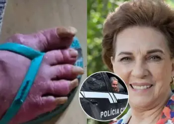 Ex-atriz da Globo é encontrada em situação precária e desumana: 'muita fome e geladeira vazia'