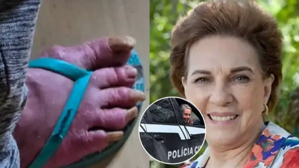 Ex-atriz da Globo é encontrada em situação precária e desumana: 'muita fome e geladeira vazia'