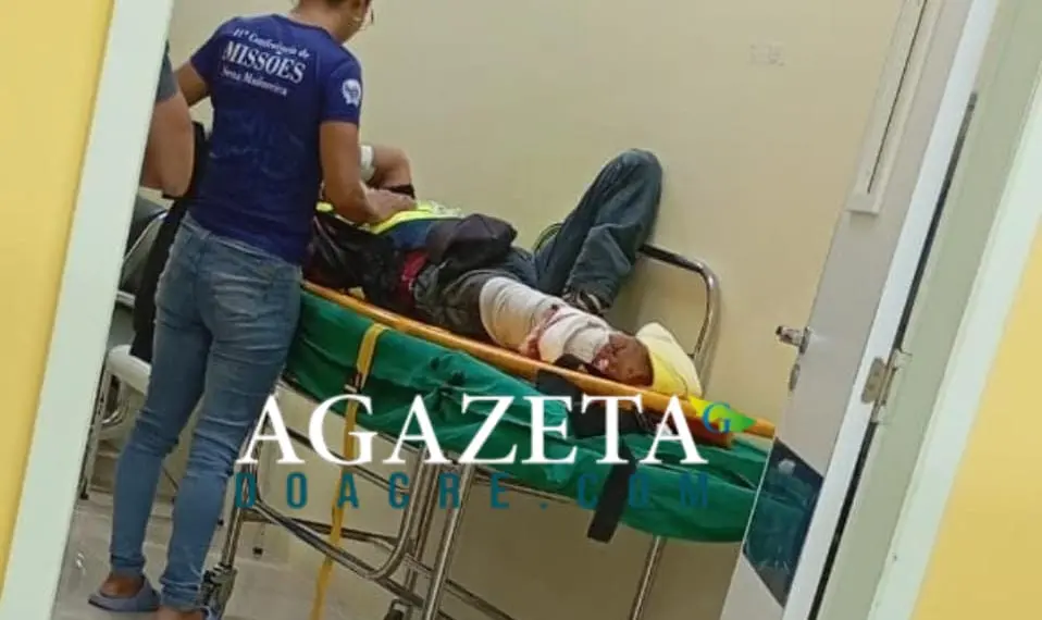 Mototaxista de 63 anos sofre fratura exposta em Sena Madureira após colidir contra carreta