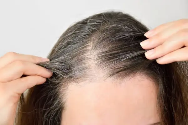 Fim dos cabelos brancos? Tratamento chinês com injeções promete repigmentação natural