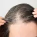 Injeções que prometem trazer de volta cor natural do cabelo branco - Depositphotos/cunaplus