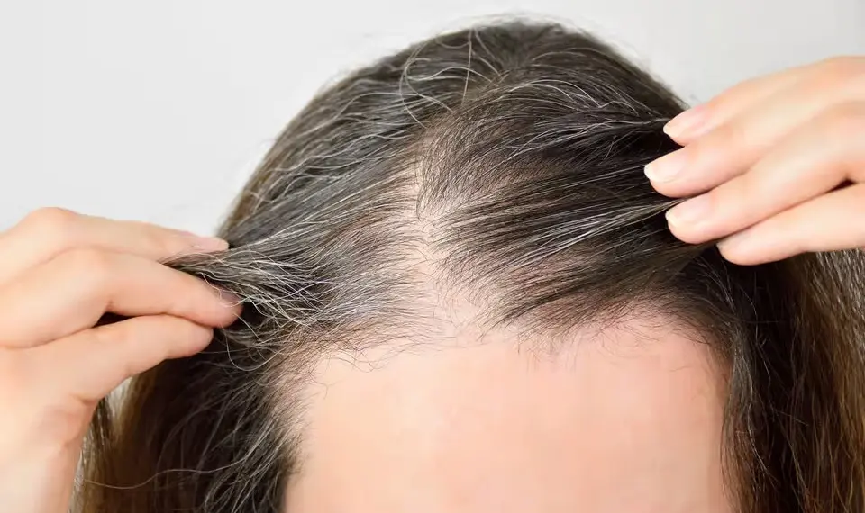 Injeções que prometem trazer de volta cor natural do cabelo branco - Depositphotos/cunaplus