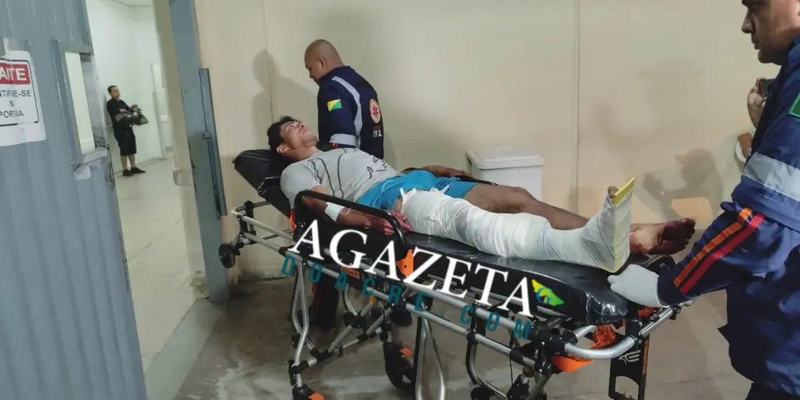 Trabalhador sofre fratura exposta após ser atingido por trator no interior do Acre