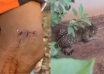 homem arranhado por onça ao tentar impedir que animal entrasse em creche — Foto: Fábio Diniz/Rede Amazônica