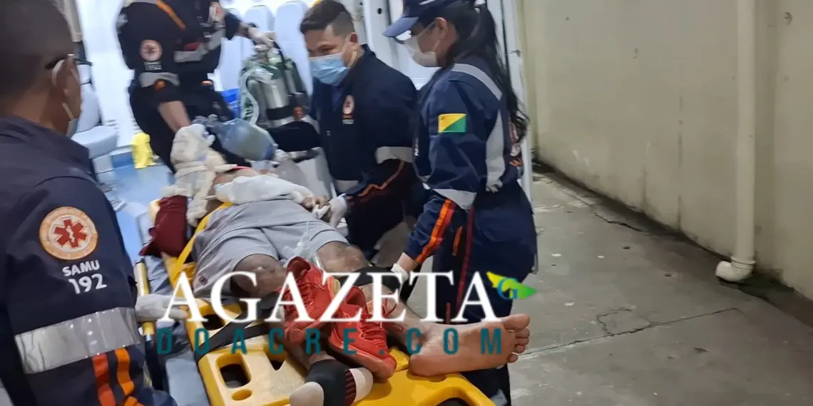 Motociclista sofre acidente e é intubado após bater em poste em Rio Branco