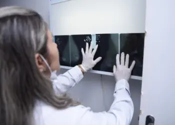 Diagnóstico precoce por meio da mamografia é determinante para a cura do câncer de mama. Foto: Arquivo
