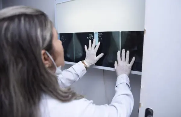 Câncer de mama: Acre soma 391 novos casos em menos de três anos, com predominância em mulheres