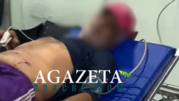 Marceneiro é baleado por ocupantes de carro enquanto estava em bar no 2º Distrito de Rio Branco 1 Marceneiro é baleado por ocupantes de carro enquanto estava em bar no 2º Distrito de Rio Branco