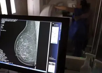 O câncer mama é o segundo câncer mais comum entre as mulheres do Brasil e do mundo, respondendo por cerca de 28% dos novos casos anuais — Foto: José Cruz/Agência Brasil