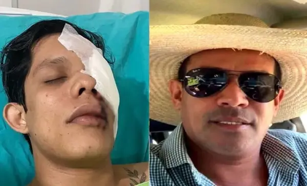 Morre empresário que cegou professor com copo de vidro em Brasiléia 1 Morre empresário que cegou professor com copo de vidro em Brasiléia