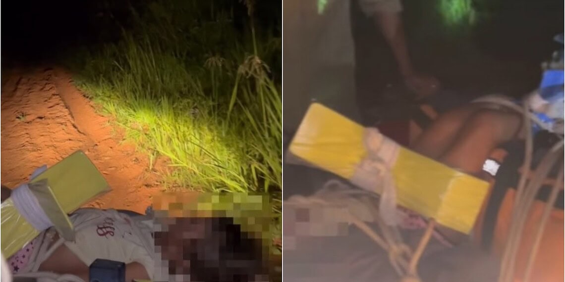 Bombeiros usam quadriciclo para resgatar criança de 8 anos ferida após queda de cavalo no Acre 1 Foto: Reprodução/Instagram