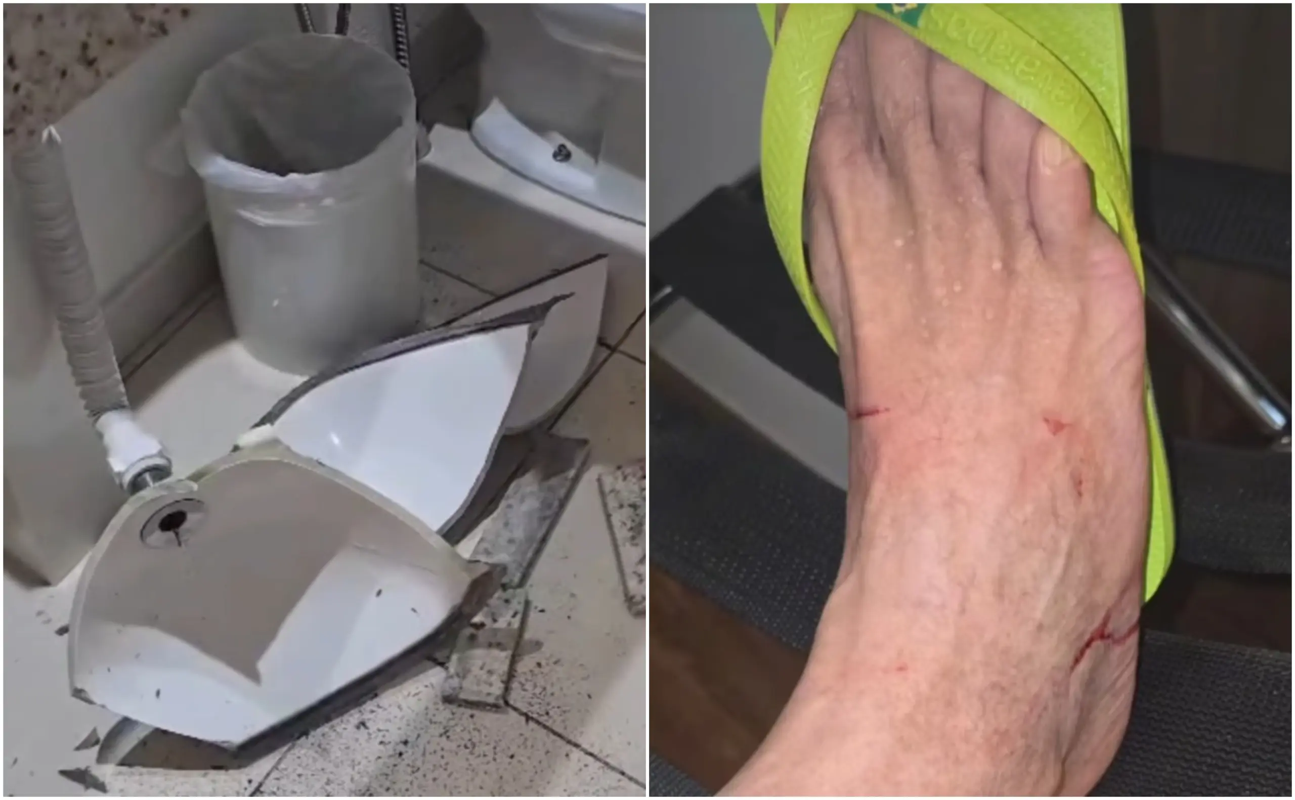 Bocalom sofre acidente em hotel durante viagem a Belo Horizonte; VÍDEO 1 Bocalom sofre acidente em hotel durante viagem a Belo Horizonte; VÍDEO