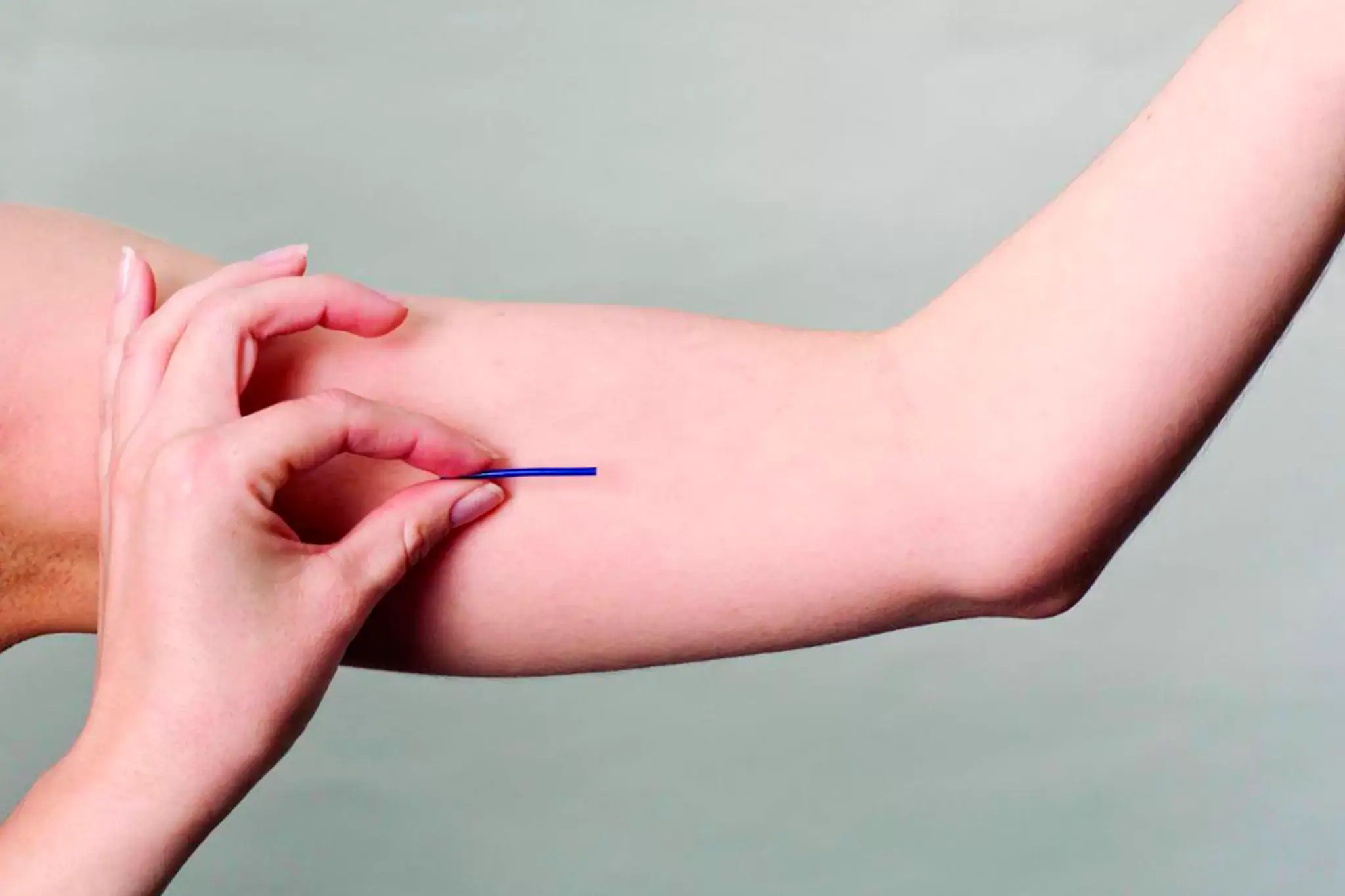 Governo do Acre distribui contraceptivos de longa duração para adolescentes nos municípios 2 Governo do Acre distribui contraceptivos de longa duração para adolescentes nos municípios