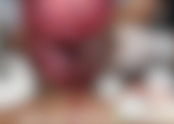 Jovem indígena sofre escalpelamento enquanto operava draga no Rio Acre, em Assis Brasil 3 Jovem indígena sofre escalpelamento enquanto operava draga no Rio Acre, em Assis Brasil