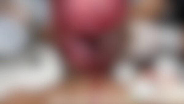 Jovem indígena sofre escalpelamento enquanto operava draga no Rio Acre, em Assis Brasil