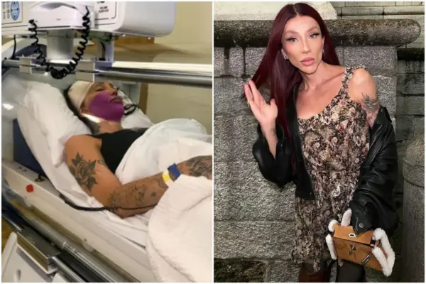 Maya Massafera tira ossos do maxilar em nova cirurgia