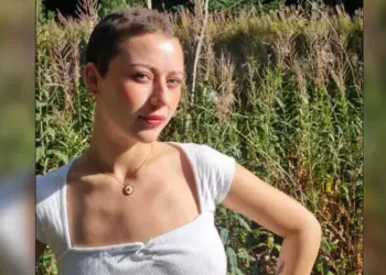 Jovem de 23 anos perde todo o cabelo após crise de estresse no trabalho 1 Reprodução / Redes sociais