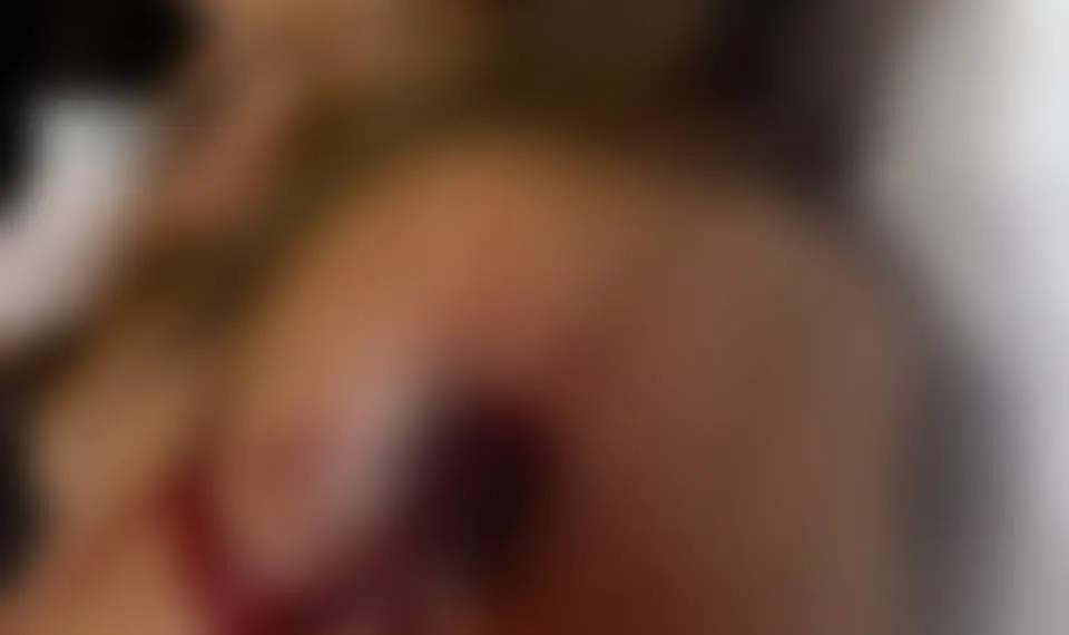 Mulher é ferida com um tiro dentro de casa em Porto Walter; ex-marido é suspeito do crime 1 Mulher é ferida com um tiro dentro de casa em Porto Walter; ex-marido é suspeito do crime