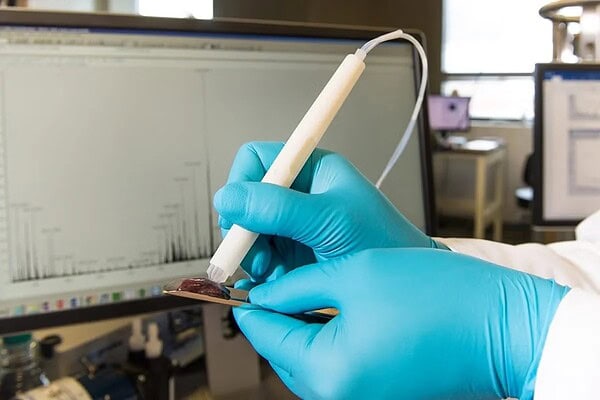 Caneta que detecta câncer em segundos é testada pela 1ª vez no Brasil