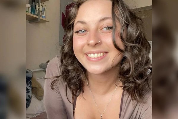 AVC: jovem de 20 anos relata único sintoma que sentiu antes de derrame