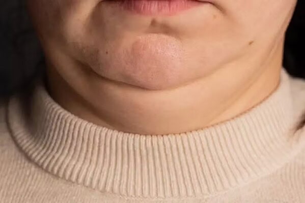 O que o tamanho do seu pescoço pode dizer sobre sua saúde?