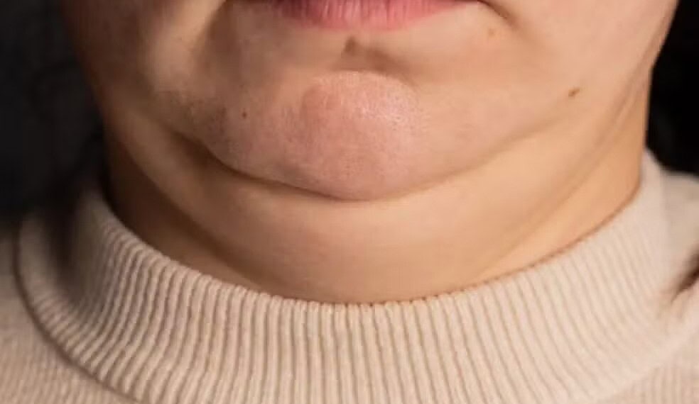 O que o tamanho do seu pescoço pode dizer sobre sua saúde? 1 Se o seu pescoço estiver mais grosso ou mais fino do que o normal, isso pode indicar algumas condições de saúde. — Foto: Getty Images via BBC