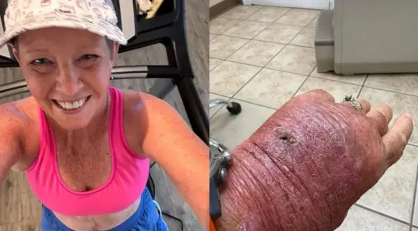 Corte com papelão infecciona e leva mulher de 63 anos ao hospital