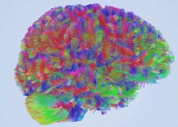 A estrutura dos nossos neurônios se altera com o passar das décadas — Foto: Alexa Mousley/Universidade de Cambridge