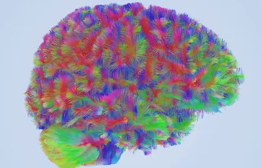 A estrutura dos nossos neurônios se altera com o passar das décadas — Foto: Alexa Mousley/Universidade de Cambridge