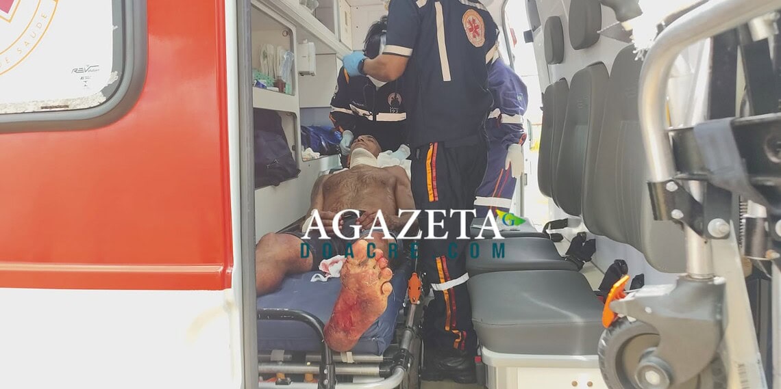Homem é ferido a golpes de terçado ao sair de casa para trabalhar no 2º Distrito