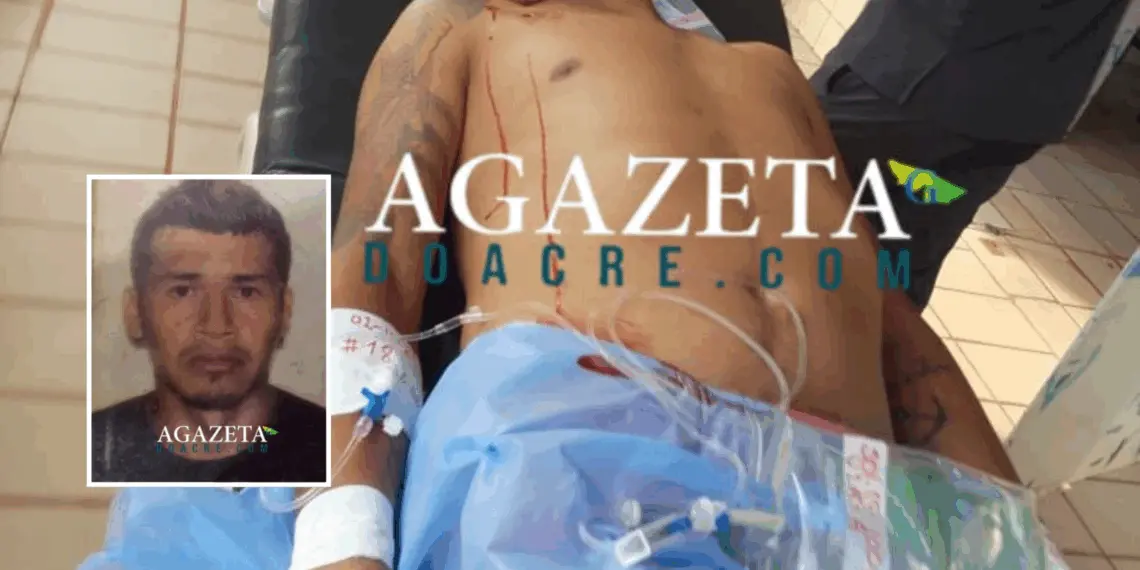 Homem é baleado em área de fronteira com o Acre e passa por cirurgia 1 Homem é baleado em área de fronteira com o Acre e passa por cirurgia