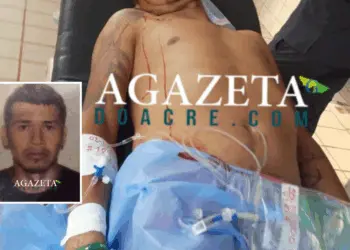 Homem é baleado em área de fronteira com o Acre e passa por cirurgia 2 Homem é baleado em área de fronteira com o Acre e passa por cirurgia