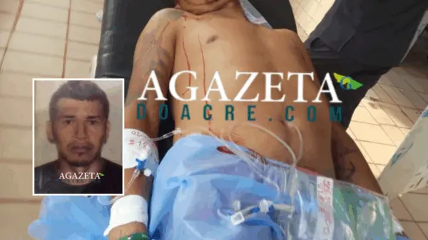 Homem é baleado em área de fronteira com o Acre e passa por cirurgia