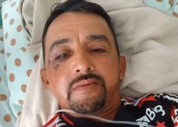 Gari agredido após se recusar a recolher vidro fará cirurgia para reconstruir o rosto 3 Foto: Arquivo Pessoal