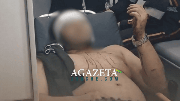 Homem é agredido com golpes de garrafa durante bebedeira em Rio Branco