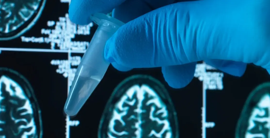 Brasileiros testam potencial remédio de baixo custo contra Alzheimer 1 Foto: Westend61 / Getty Images