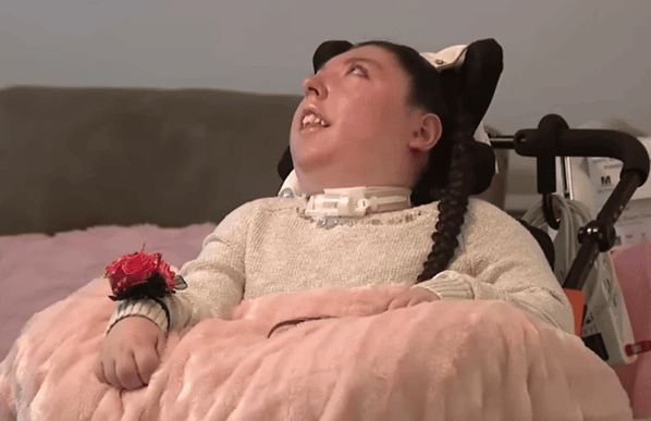 Jovem que nasceu sem cérebro desafia a medicina e completa 20 anos