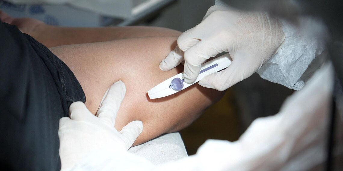 Mais de 50 mulheres recebem implante contraceptivo em ação da Prefeitura de Rio Branco 1 Mais de 50 mulheres receberam o implante contraceptivo Implanon em um único dia. Foto:Yago Aiache/Secom