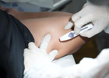 Mais de 50 mulheres recebem implante contraceptivo em ação da Prefeitura de Rio Branco 2 Mais de 50 mulheres receberam o implante contraceptivo Implanon em um único dia. Foto:Yago Aiache/Secom